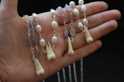 Human teeth necklace