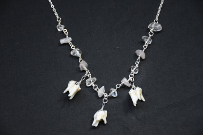 Teeth necklaces