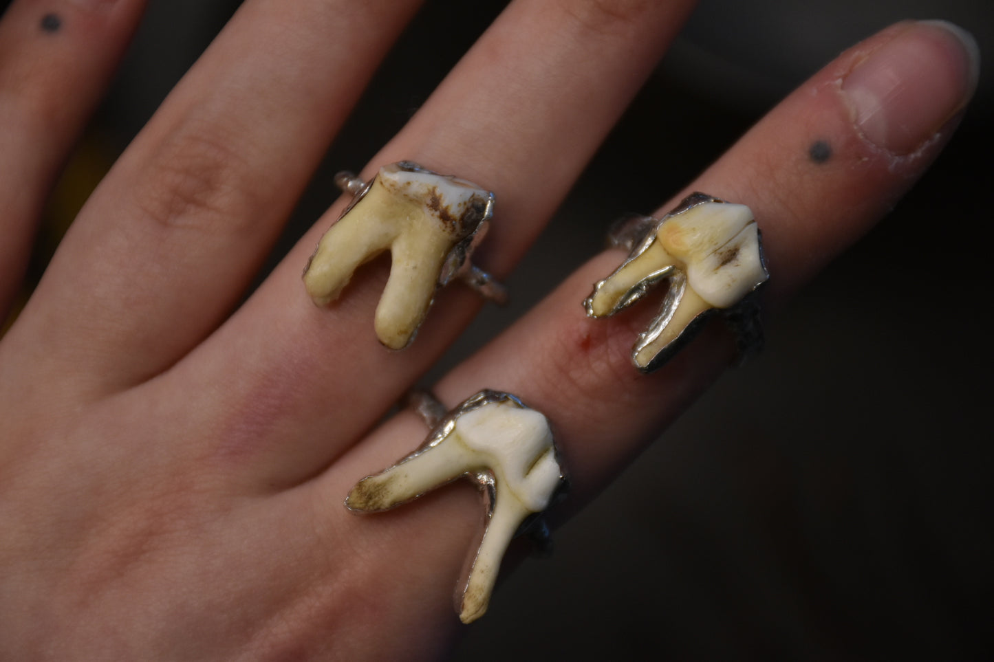 Soldered tooth rings