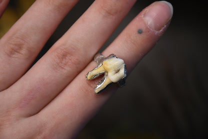 Soldered tooth rings