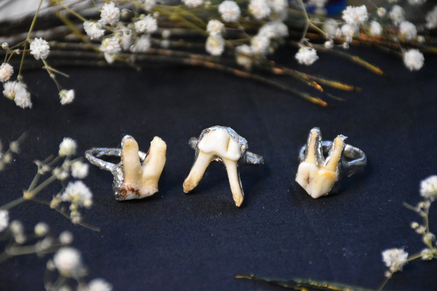 Soldered tooth rings