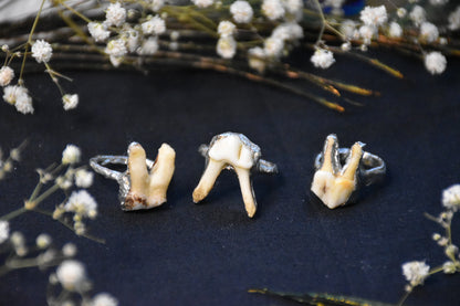 Soldered tooth rings