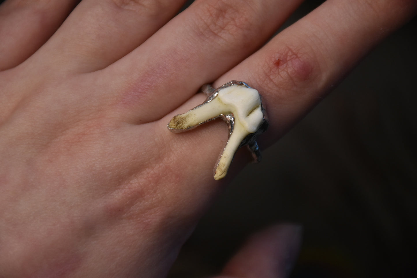 Soldered tooth rings