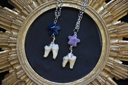 Fox tooth necklace